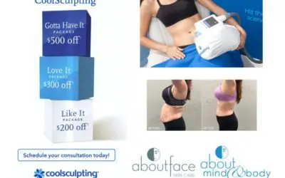 5 Reasons You Should Consider CoolSculpting