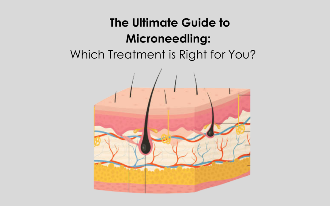 Microneedling 101: Which is Best for You?