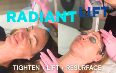 Radiant Lift in Snellville, Dacula, & Athens, GA