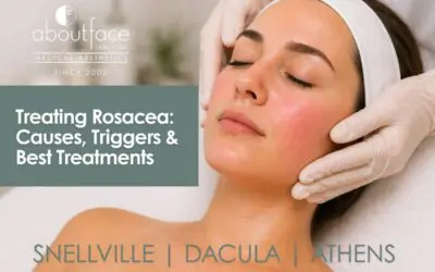 Best Rosacea Treatments in Snellville, Dacula & Athens, GA