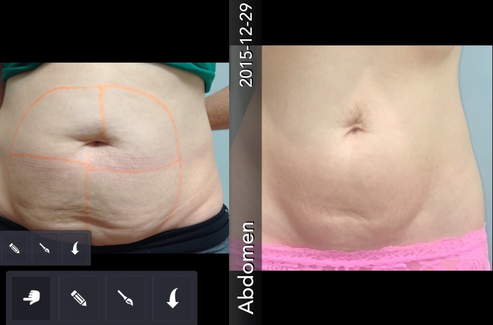 bodyfx figure 8 before and after